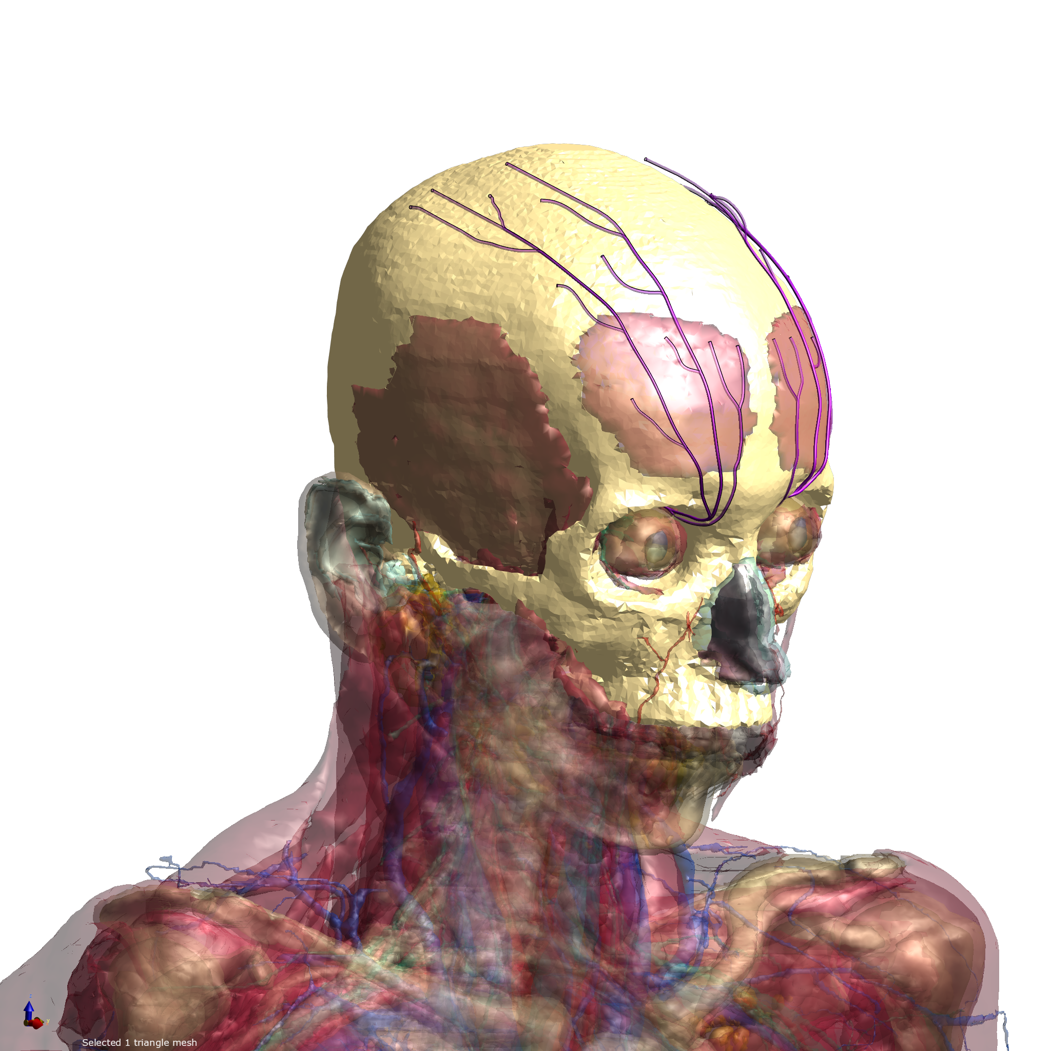 Figure 1: Virtual Population model with sub-cutaneous nerves inserted in the anatomy