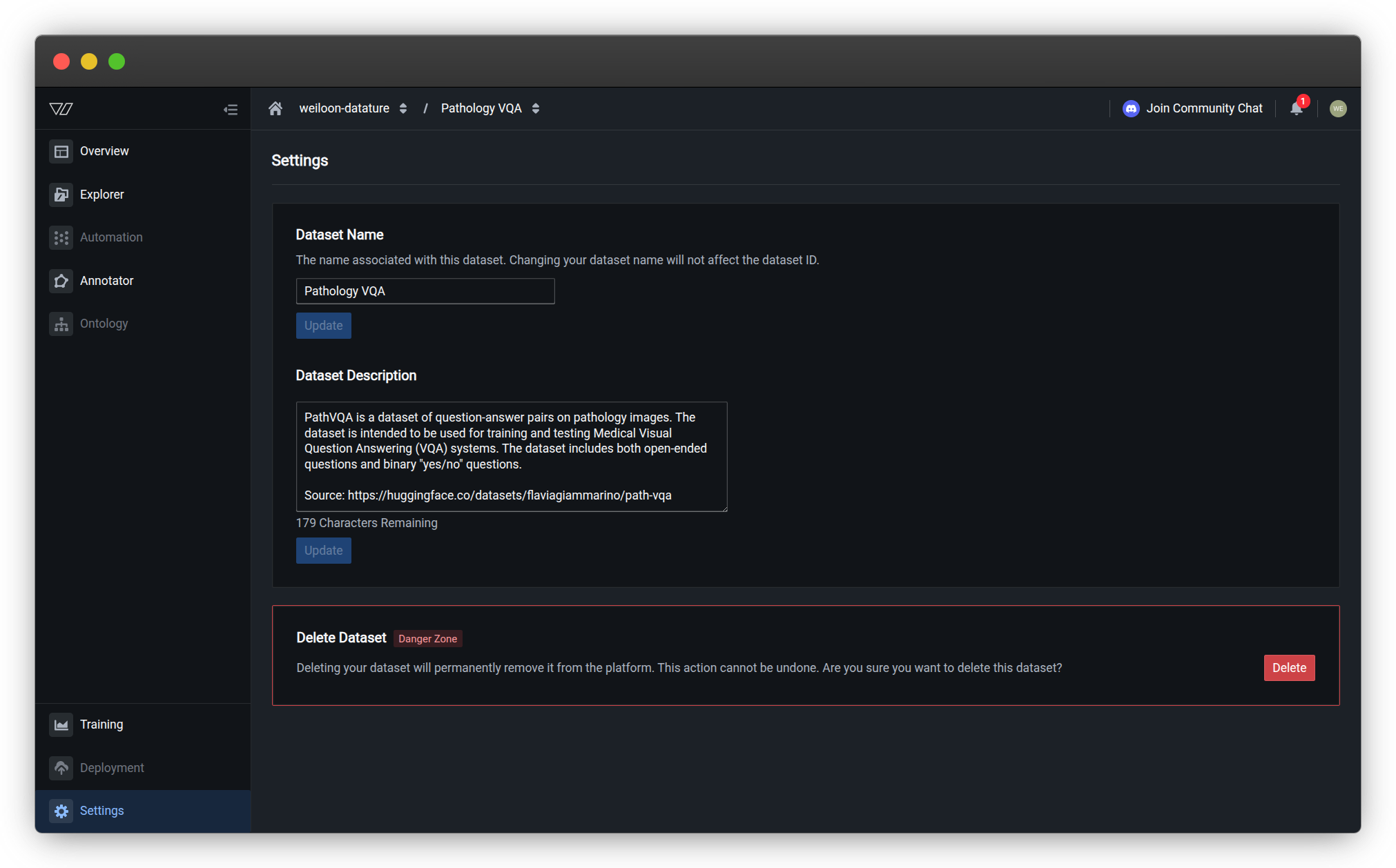 Dataset Settings page showing the Dataset Name field and Update button