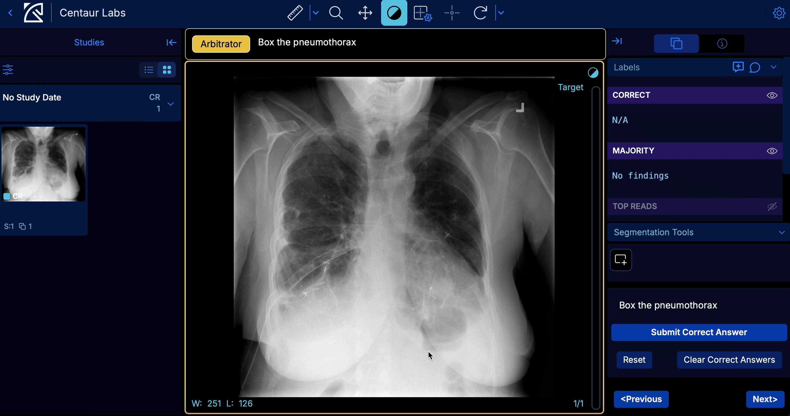Box segmentation in arbitrator view