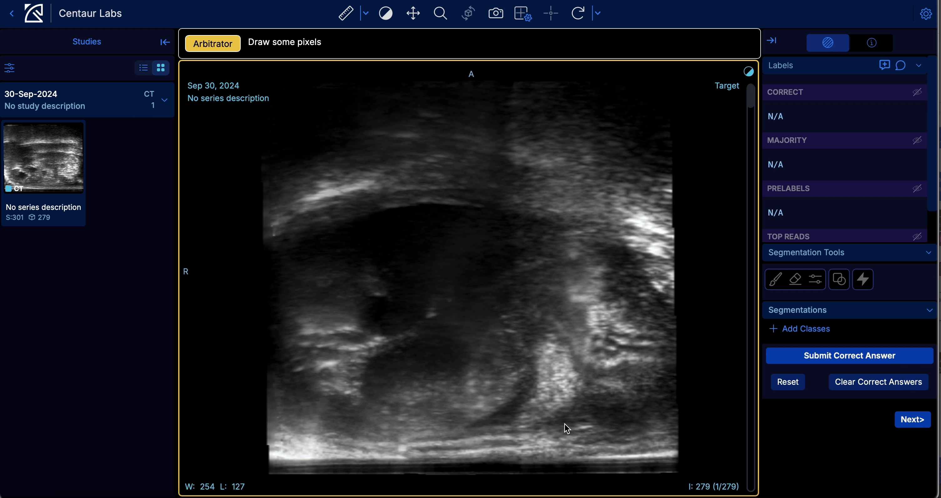 Pixel segmentaiton in arbitrator view