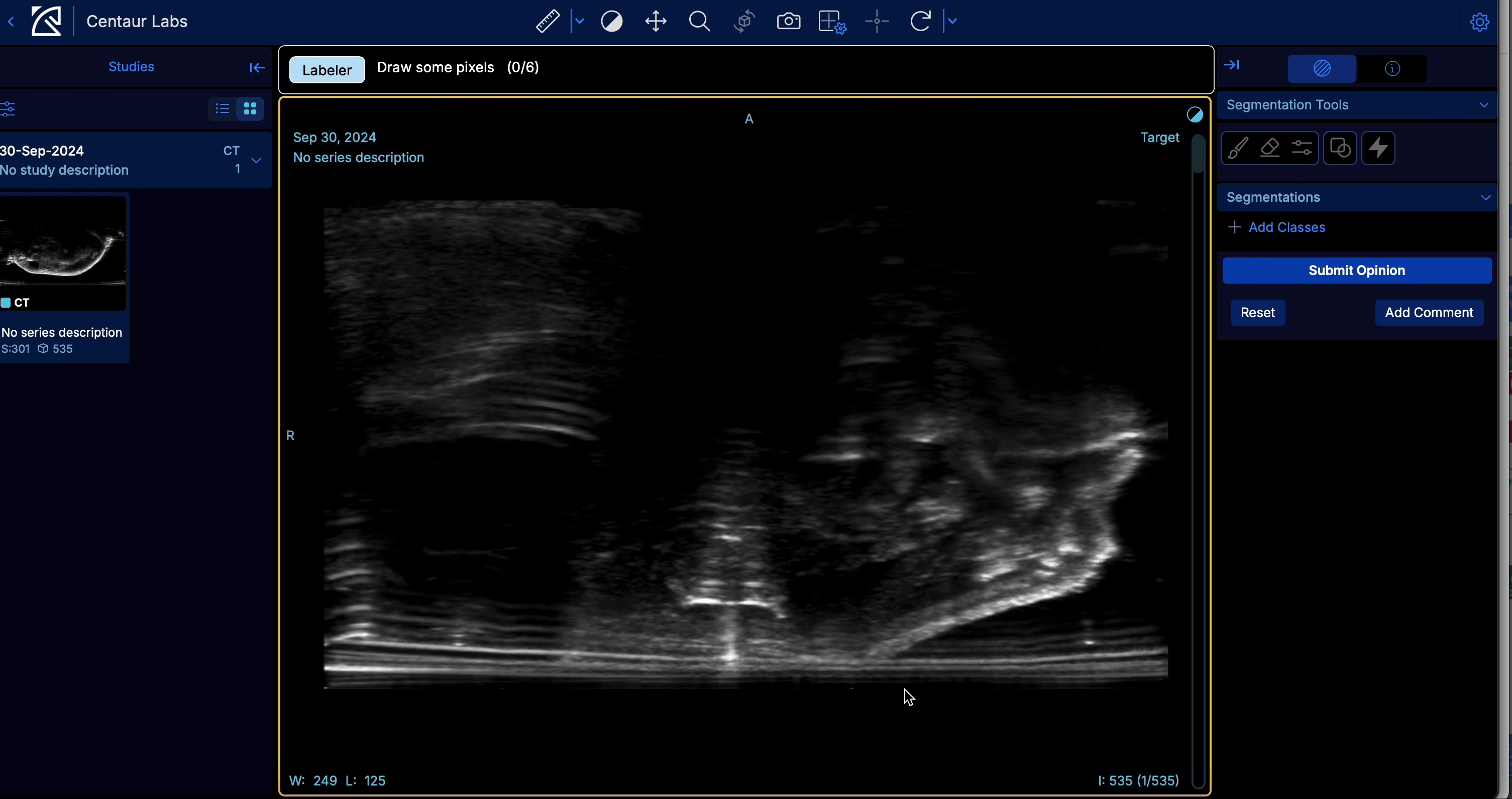 Pixel segmentation in labeler view