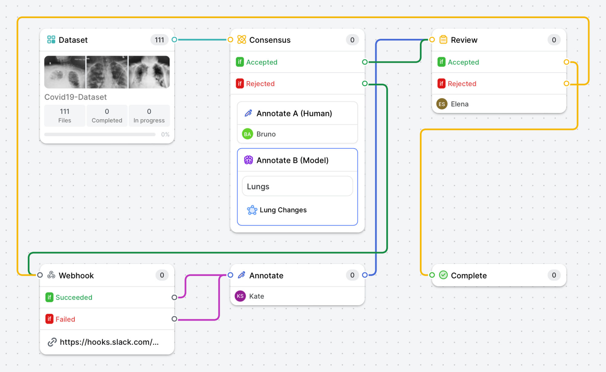 Use workflows to manage your projects