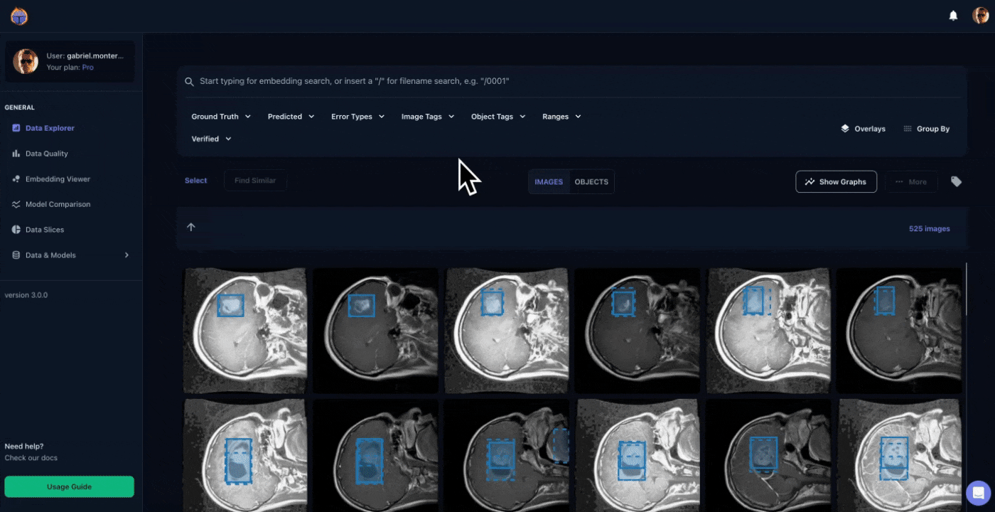 Video of filtering results by tags on the tenyks platform