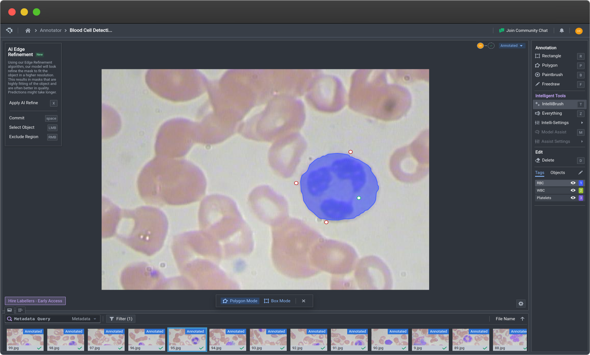 Making refinements on IntelliBrush using multiple negative markers (Click image to enlarge)